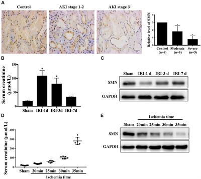 Survival Motor Neuron (SMN) Protein Insufficiency Exacerbates Renal Ischemia/Reperfusion Injury